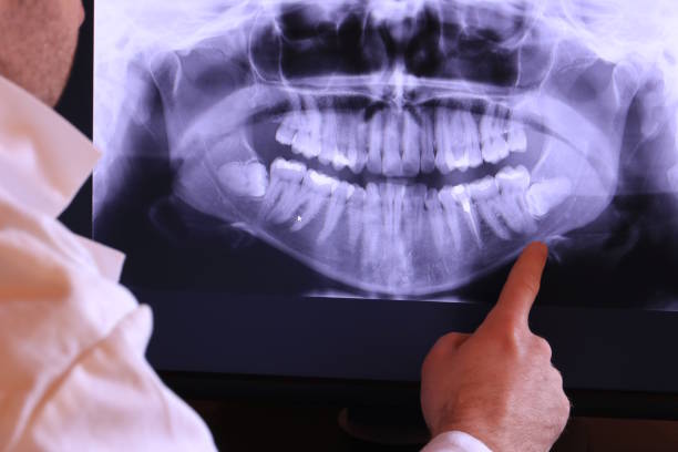 Best Emergency Dental Services for Seniors in Garrett, TX